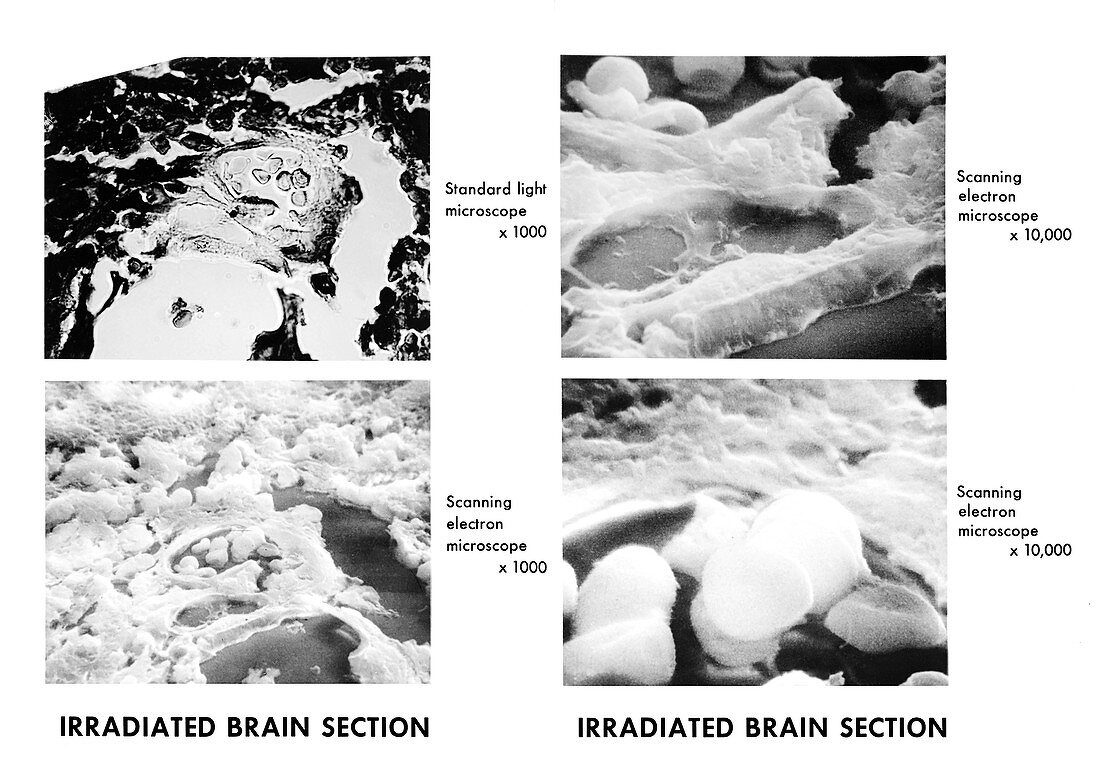 Irradiated brain sections, comparing micrographs