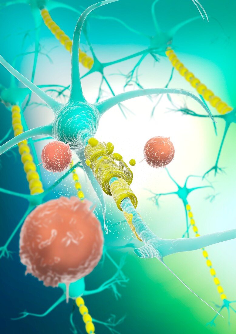 Lymphocytes attacking brain neuroglia, illustration