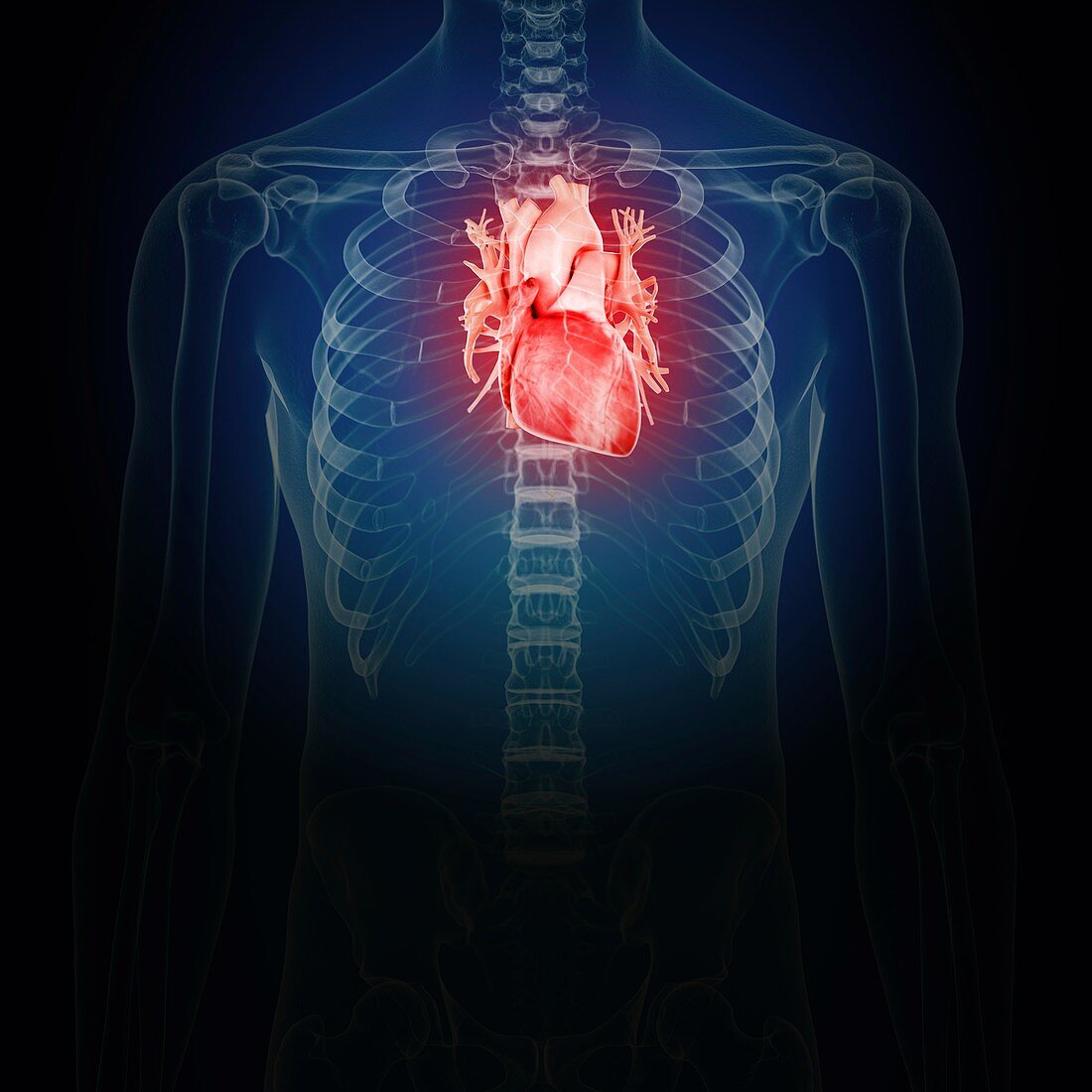 Illustration of an inflamed heart