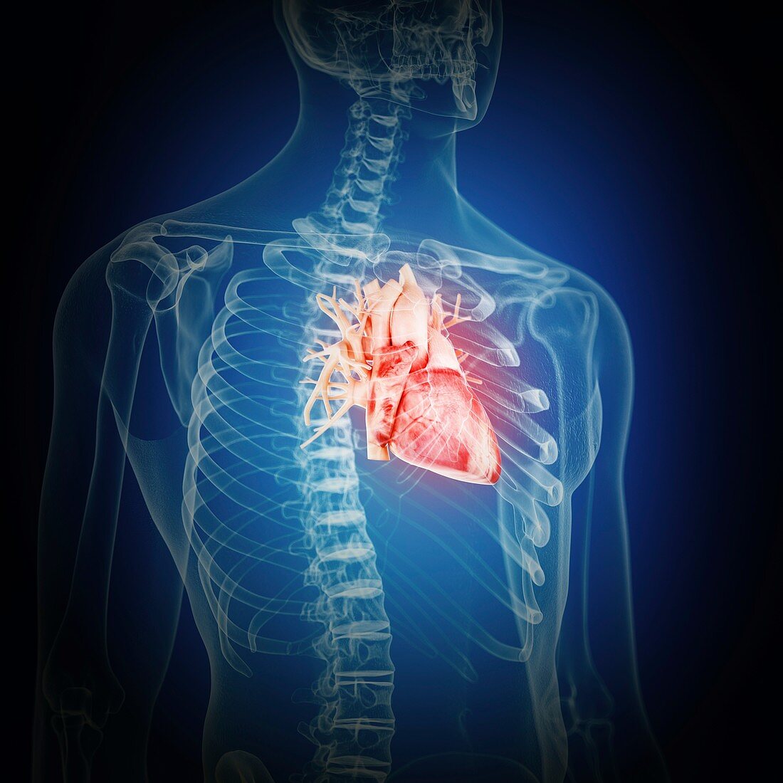 Illustration of an inflamed heart