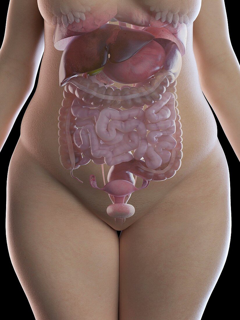 Illustration of an obese woman's organs