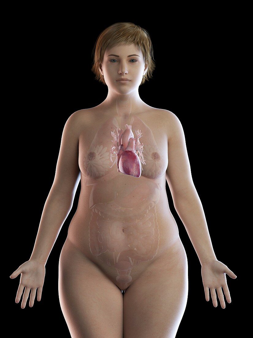 Illustration of an obese woman's heart