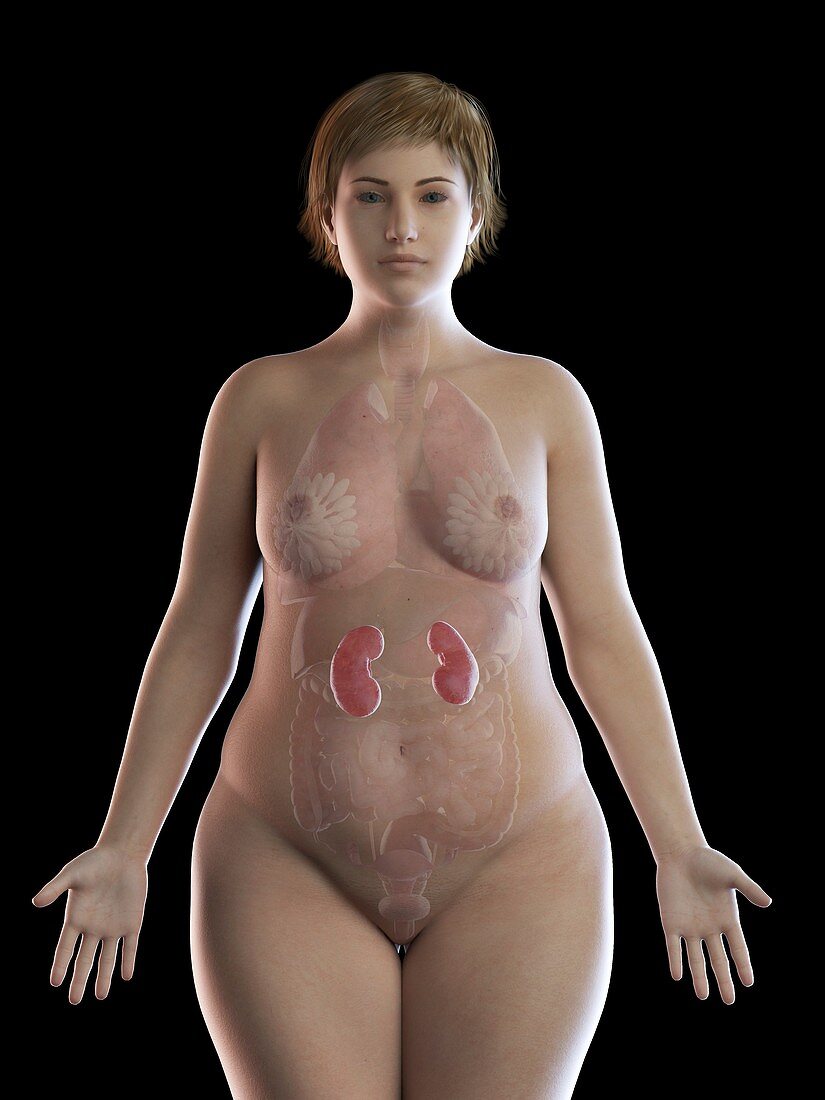 Illustration of an obese woman's kidneys