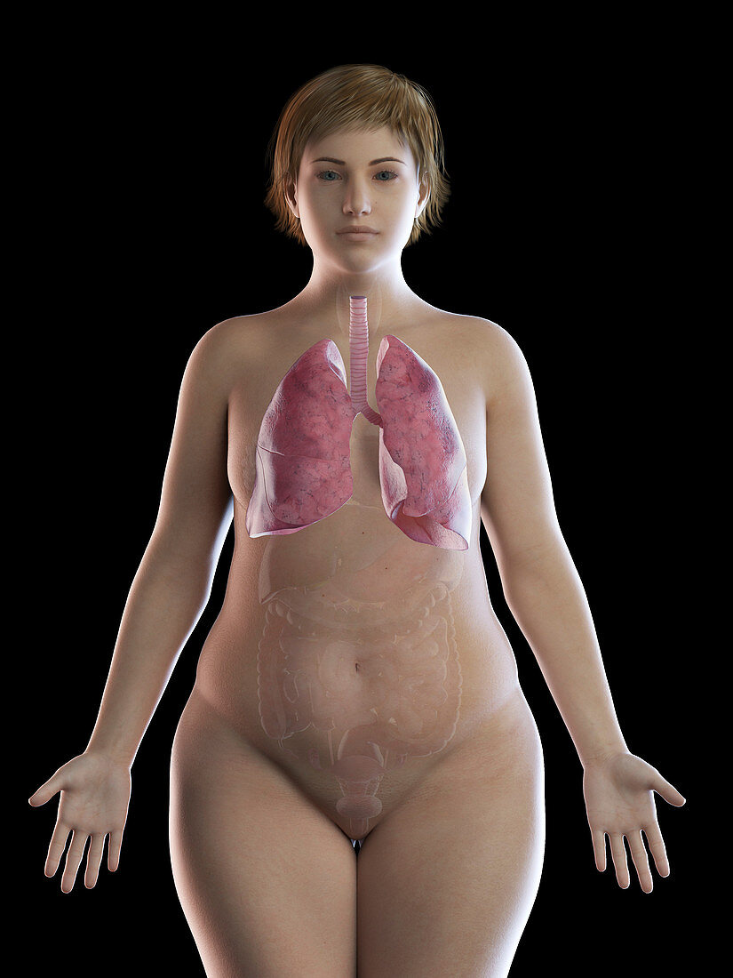 Illustration of an obese woman's lung