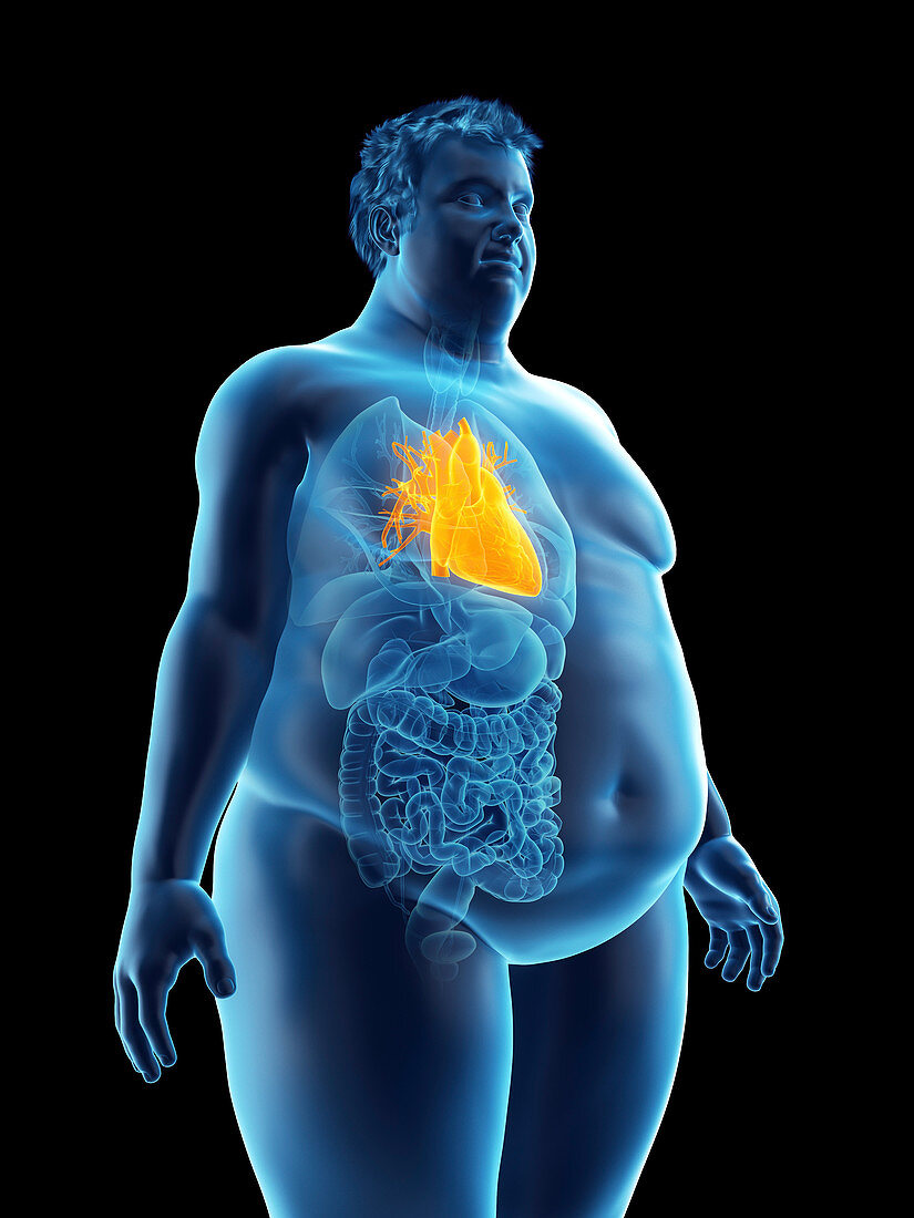 Illustration of an obese man's heart