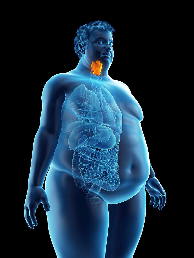 Illustration of an obese man's larynx