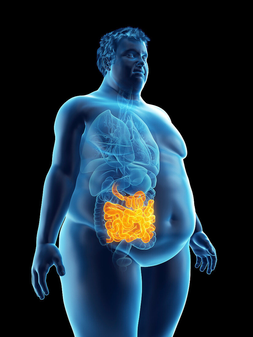 Illustration of an obese man's intestine