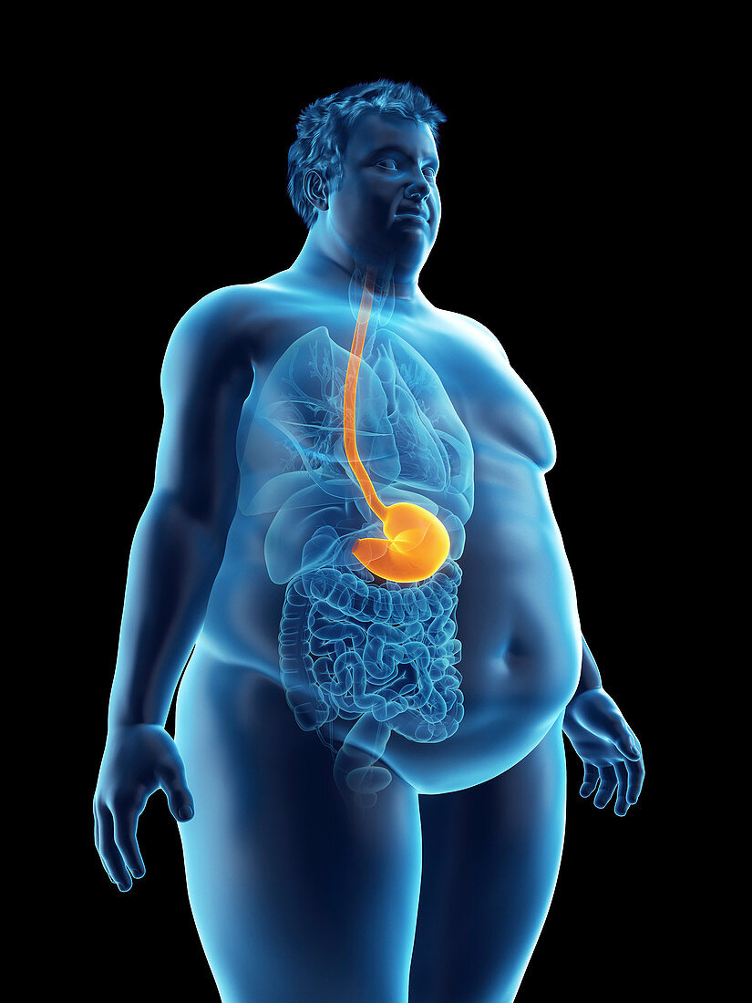 Illustration of an obese man's stomach