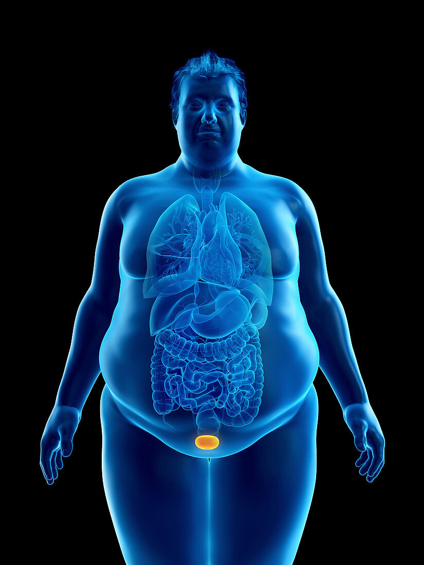 Illustration of an obese man's bladder