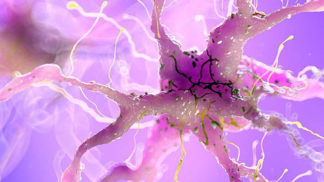 Illustration of a damaged nerve cell