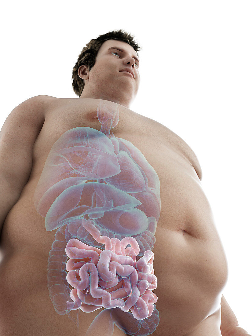 Illustration of an obese man's intestine