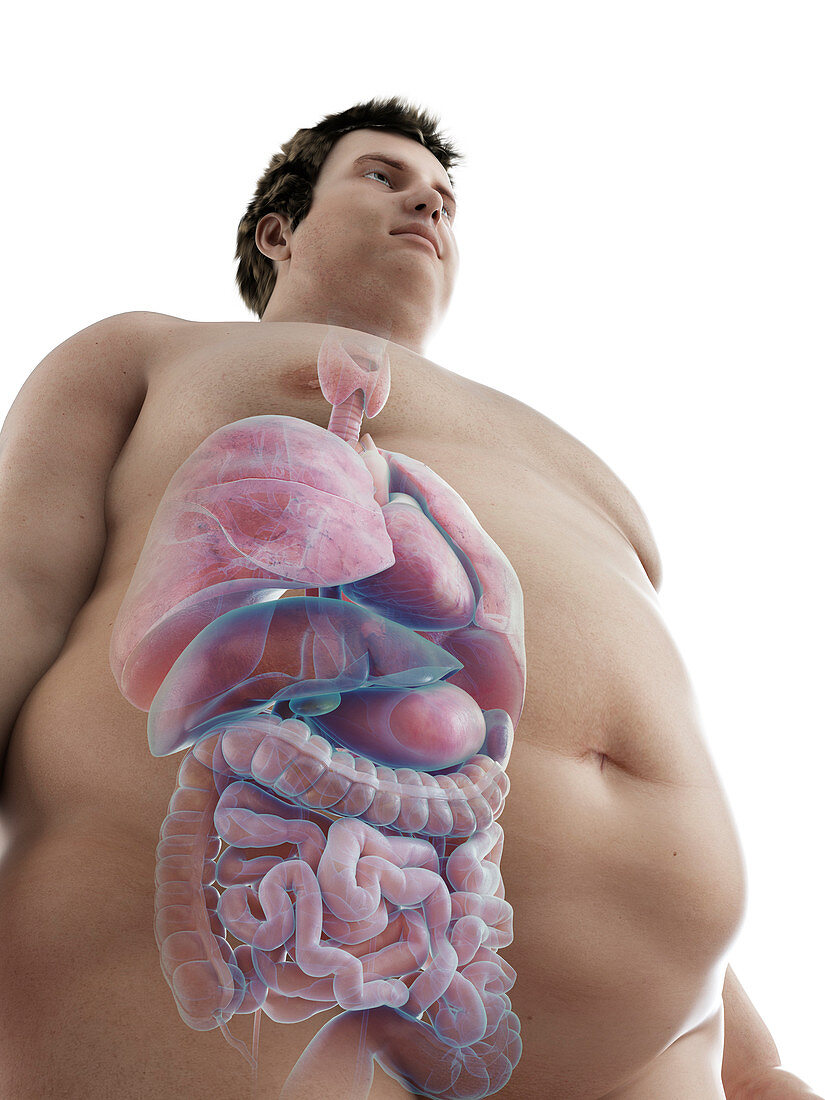 Illustration of an obese man's organs