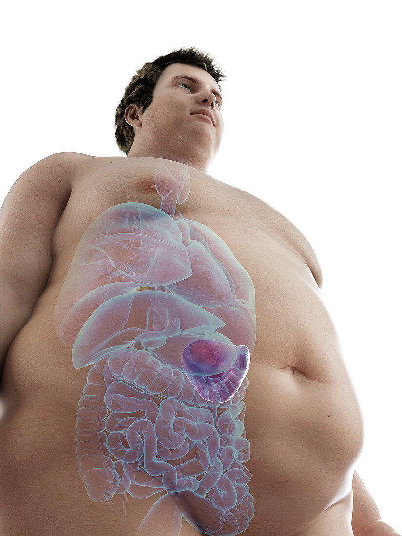 Illustration of an obese man's spleen