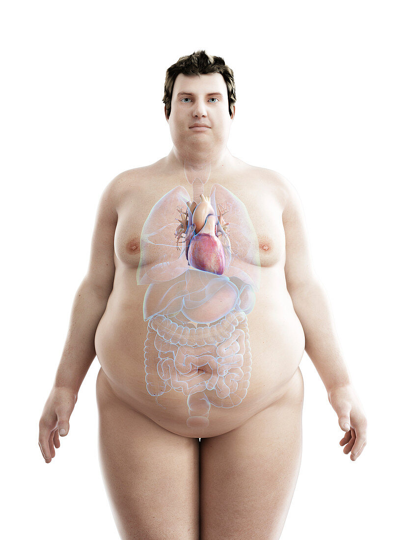 Illustration of an obese man's heart