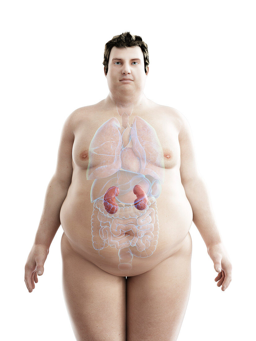 Illustration of an obese man's kidneys