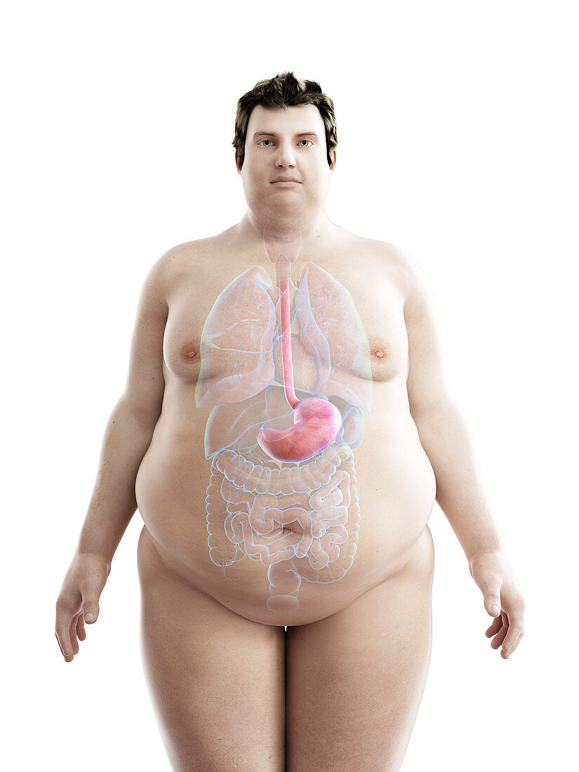 Illustration of an obese man's stomach