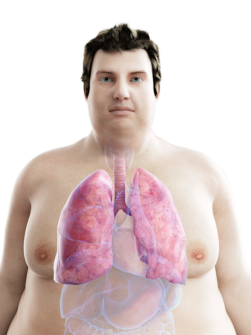 Illustration of an obese man's lungs