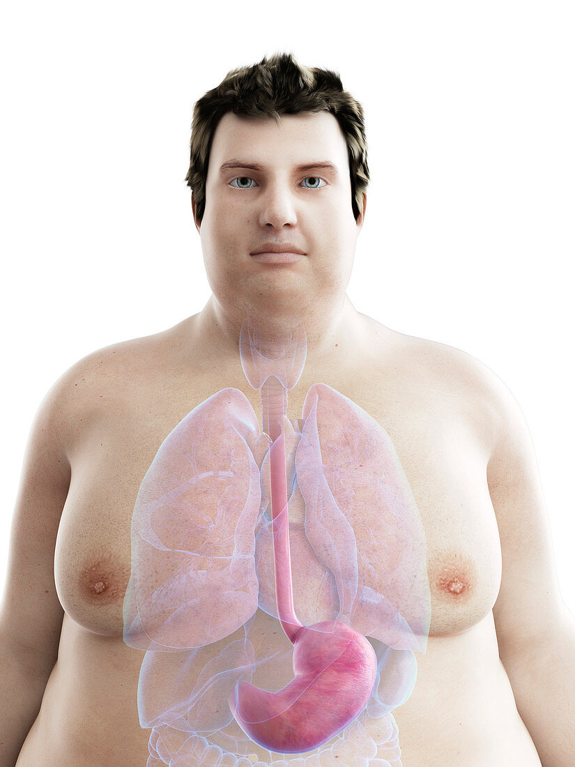 Illustration of an obese man's stomach