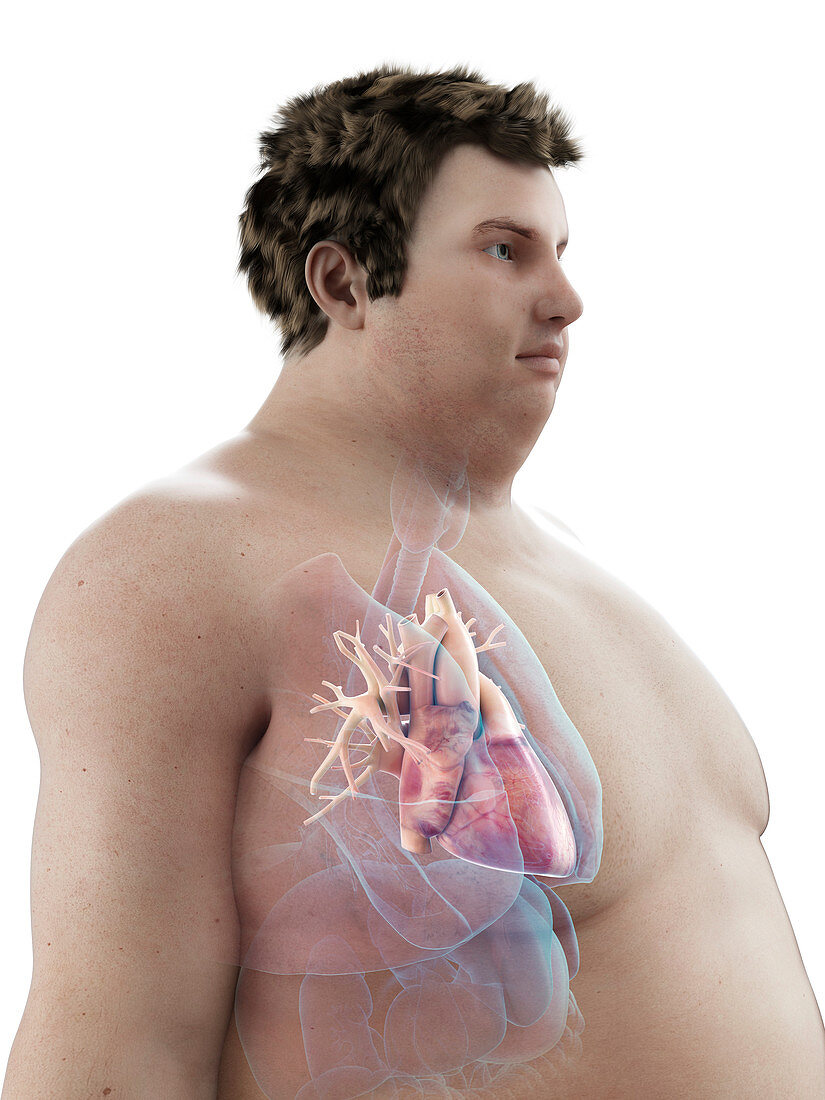 Illustration of an obese man's heart