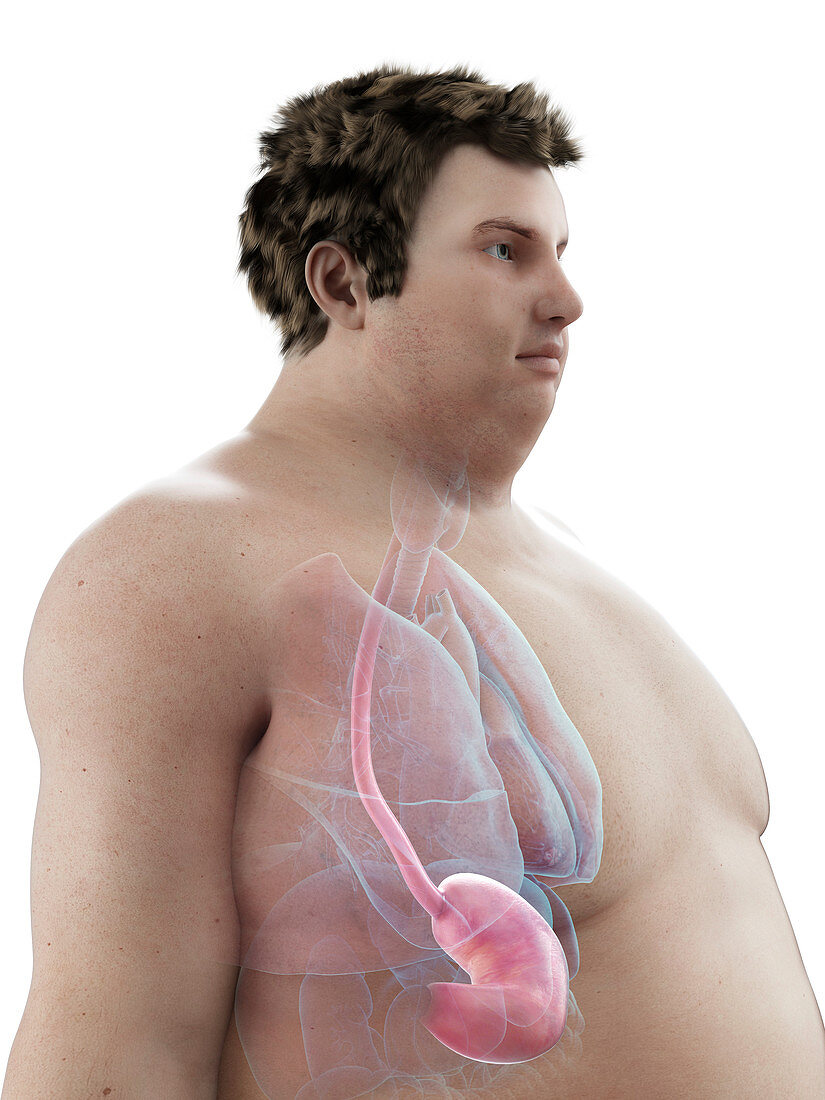 Illustration of an obese man's stomach