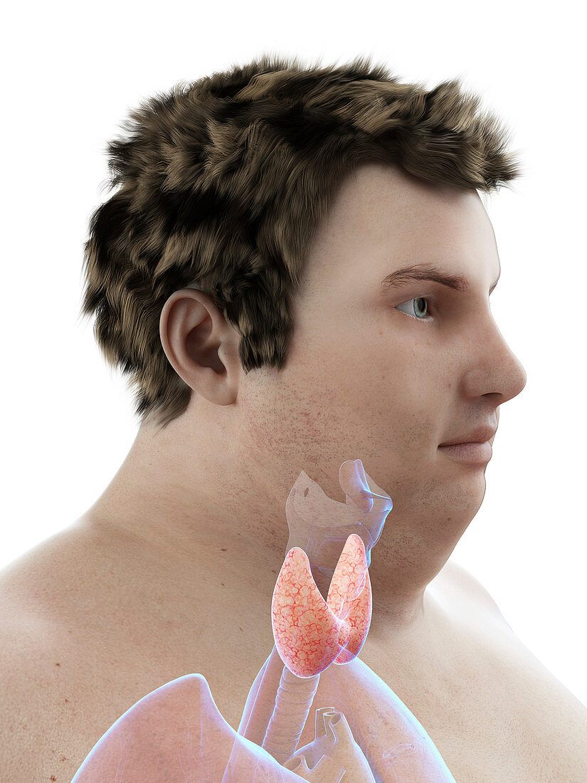 Illustration of an obese man's thyroid gland