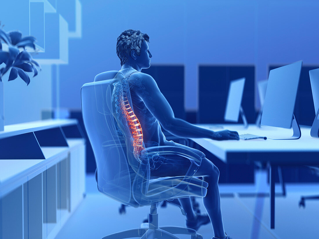 Illustration of an office worker with a painful back