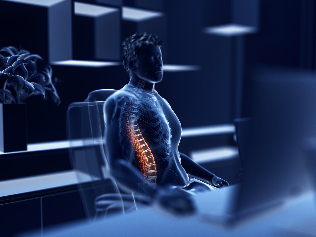 Illustration of an office worker with a painful back