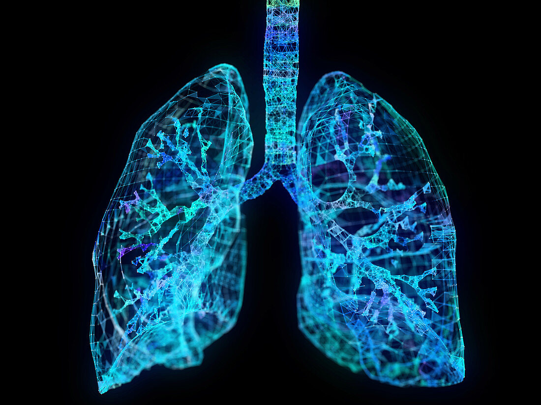 Illustration of a plexus lung