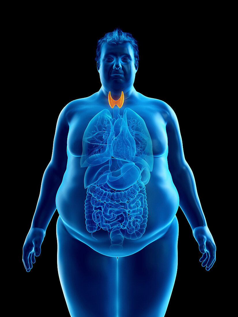 Illustration of an obese man's thyroid gland