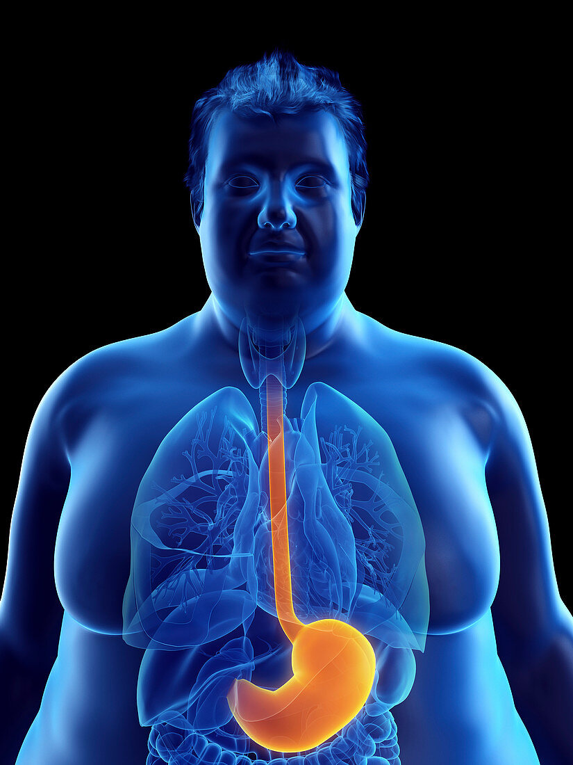 Illustration of an obese man's stomach