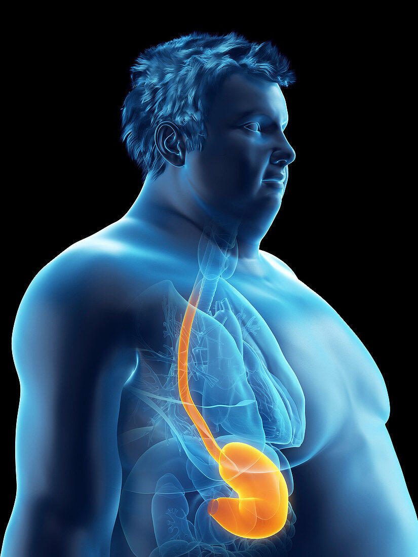 Illustration of an obese man's stomach