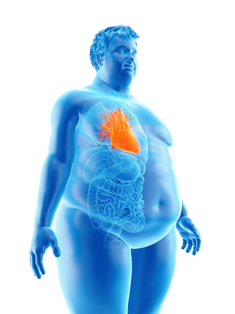 Illustration of an obese man's heart