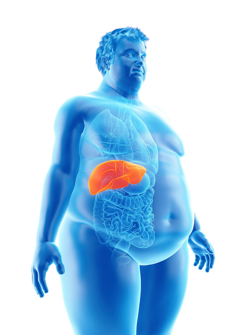 Illustration of an obese man's liver