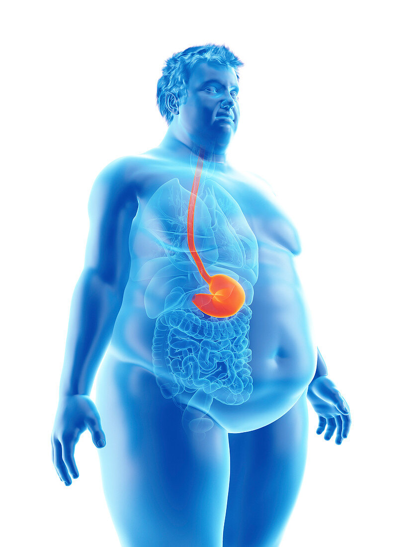 Illustration of an obese man's stomach