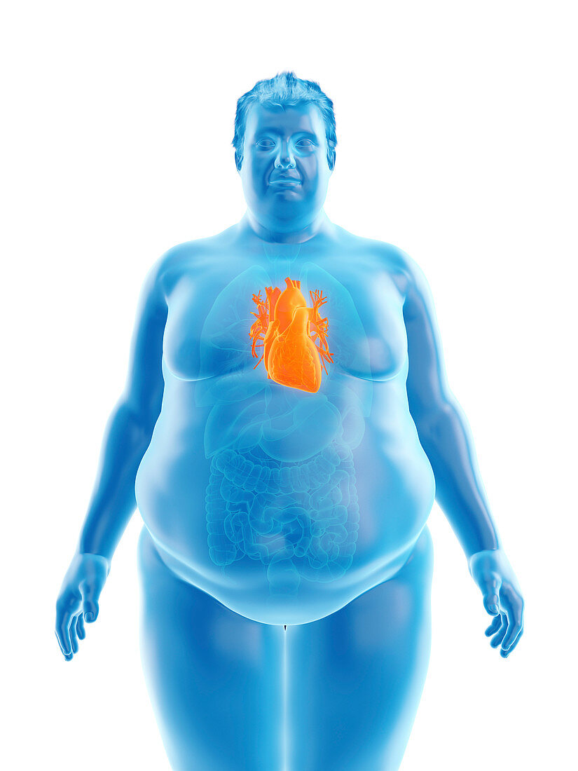 Illustration of an obese man's heart