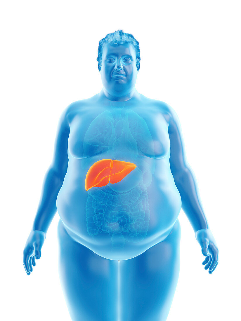 Illustration of an obese man's liver