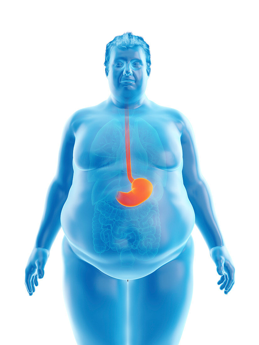 Illustration of an obese man's stomach