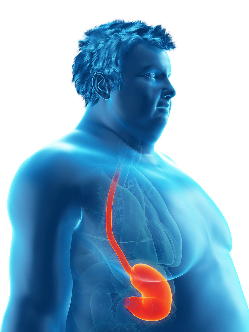 Illustration of an obese man's stomach