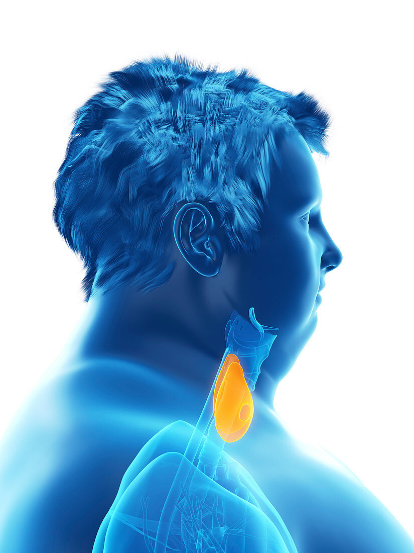 Illustration of an obese man's thyroid gland