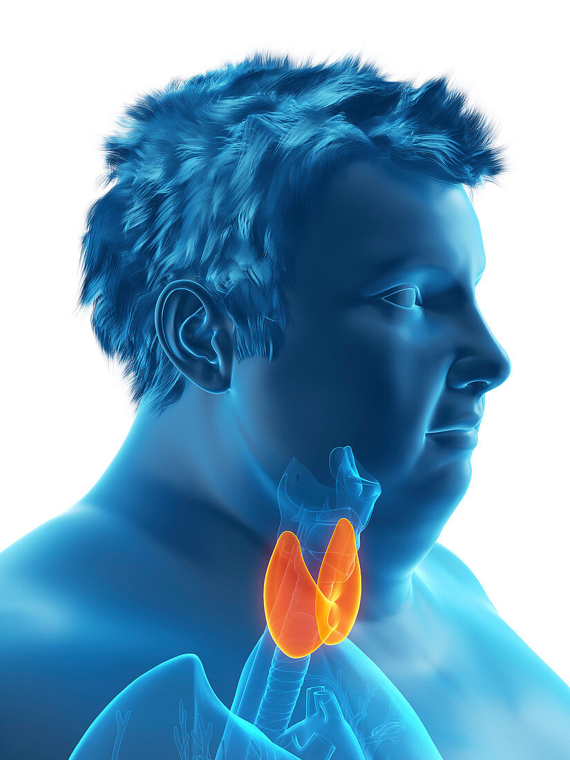 Illustration of an obese man's thyroid gland