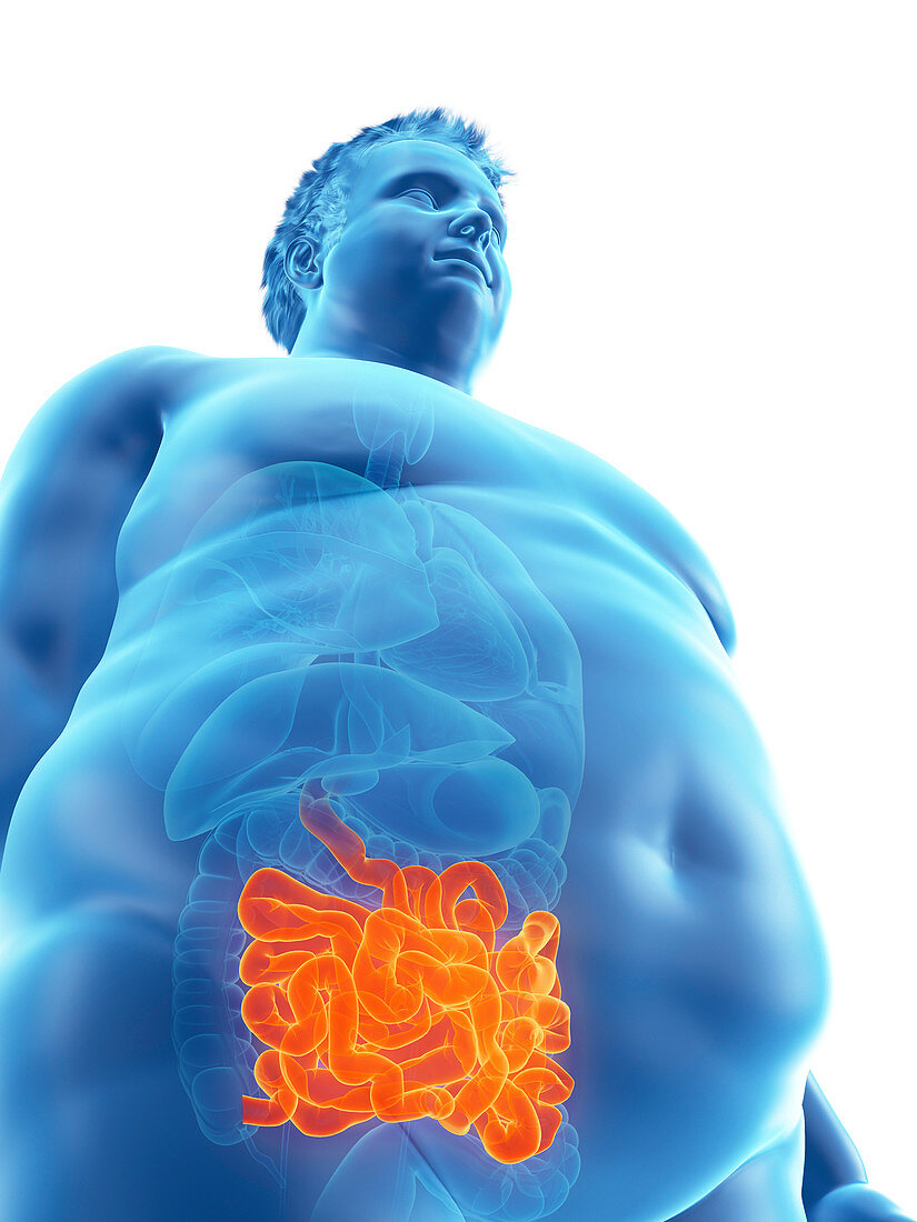 Illustration of an obese man's intestine