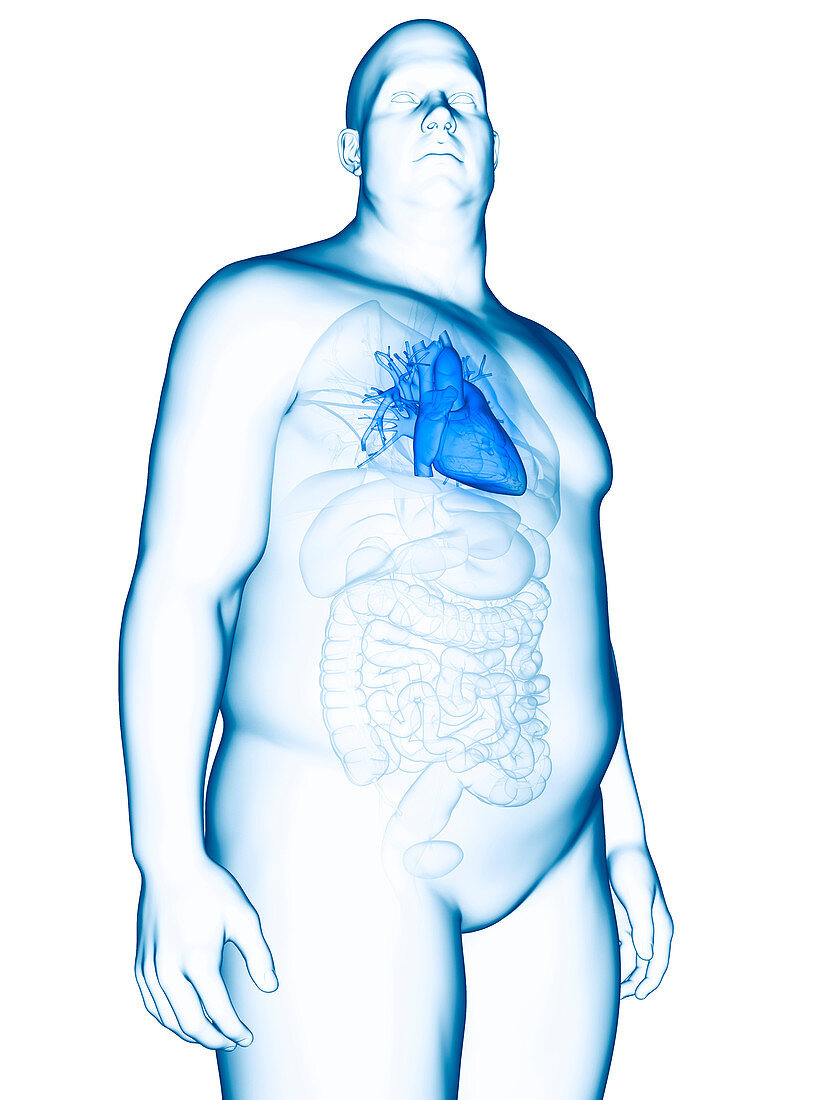 Illustration of an obese man's heart