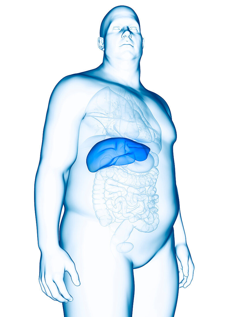 Illustration of an obese man's liver