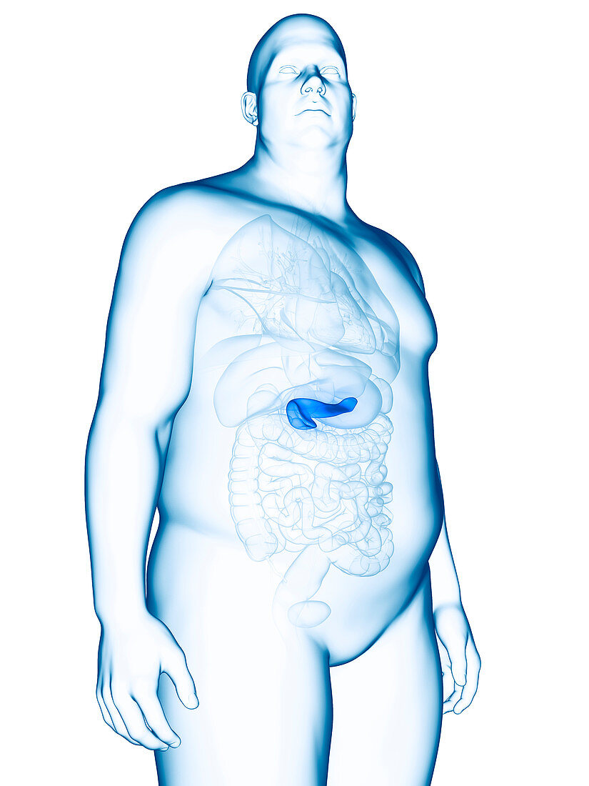 Illustration of an obese man's pancreas