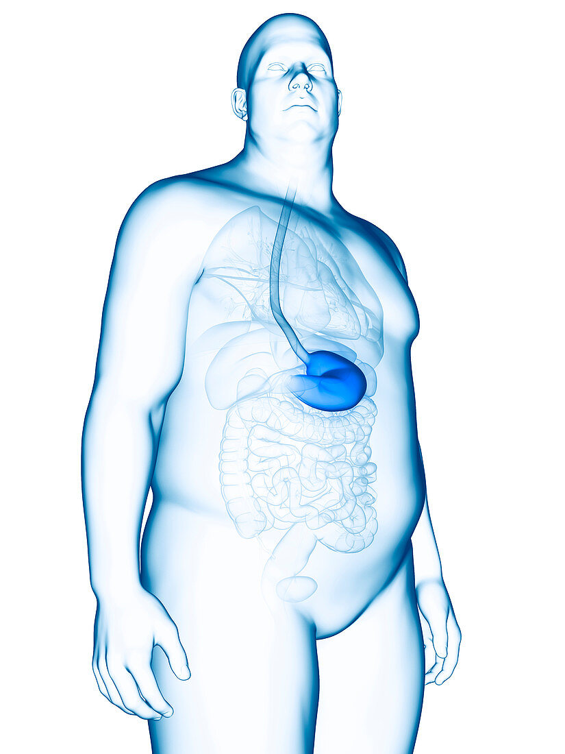 Illustration of an obese man's stomach