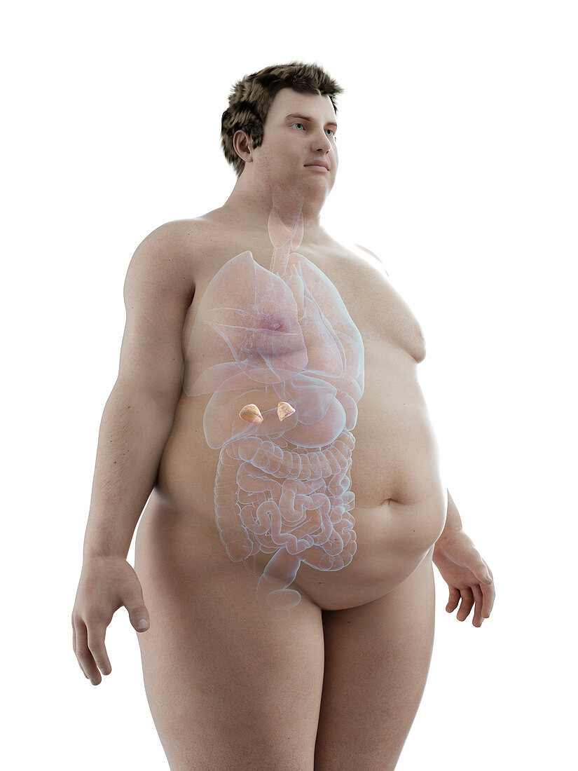 Illustration of an obese man's adrenal glands