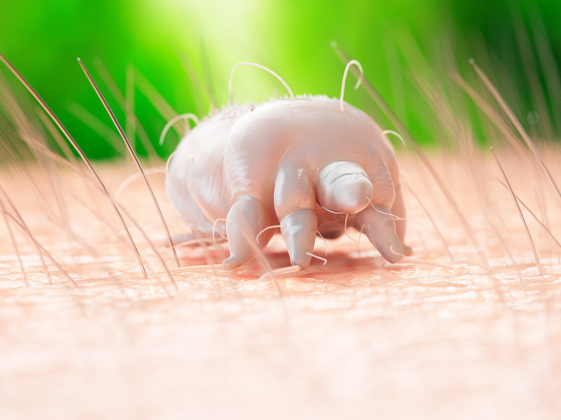 Illustration of a scabies mite on human skin