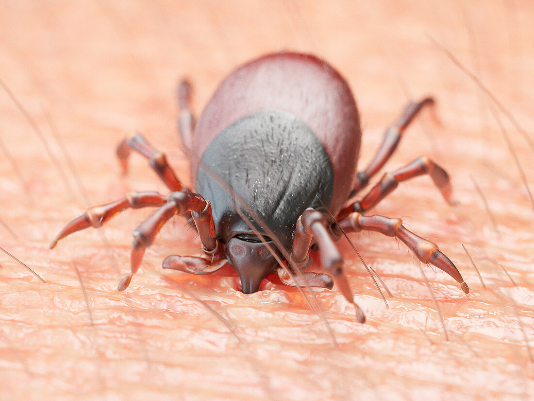 Illustration of a tick biting human skin