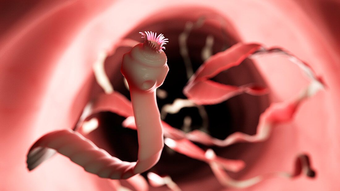 Illustration of a tapeworm