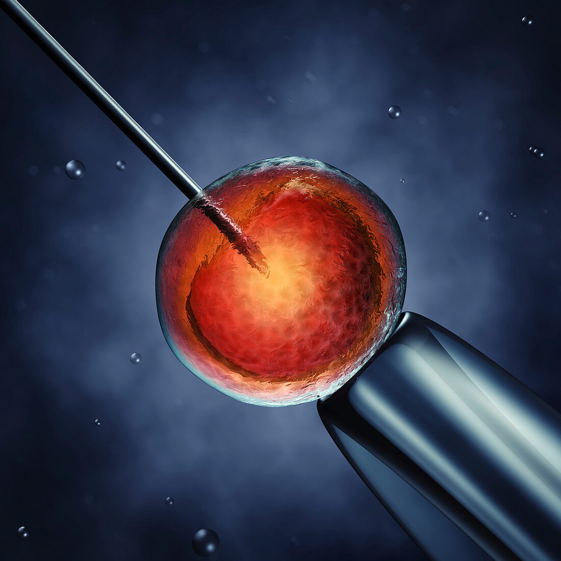 In vitro fertilization, illustration